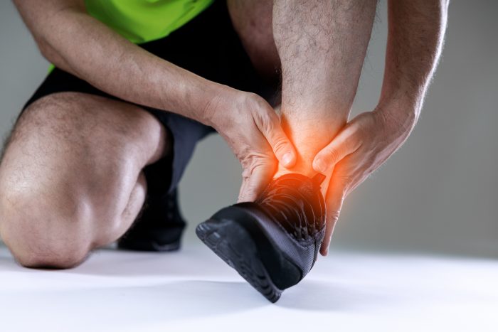A sprained ankle