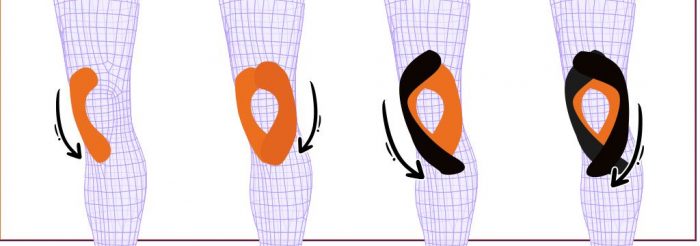 how to tape for runner's knee