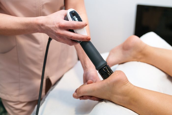A person receiving shockwave therapy for plantar fasciitis